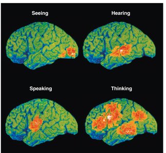 Functional neuroimaging of the cerebral cortex