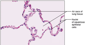 Histological section of simple squamous epithelium in lung tissue