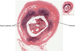 Peyer's patches in the intestine
