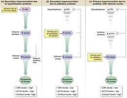 Primary and secondary endocrine pathologies