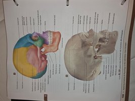 Labeled diagram of the skull, lateral view