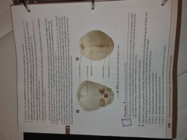 Infant skull showing fontanelles