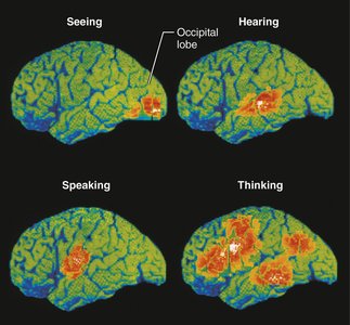 Functional neuroimaging (fMRI) of the cerebral cortex