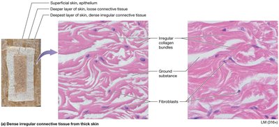 Dense irregular connective tissue from thick skin
