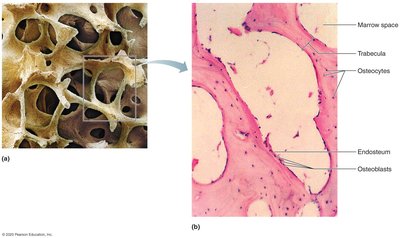 Spongy bone structure