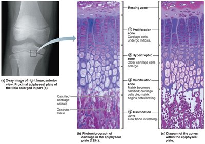 Epiphyseal plate zones in growing long bone