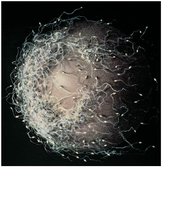 Sperm surrounding an oocyte at fertilization