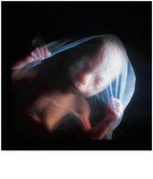 Fetus at four months