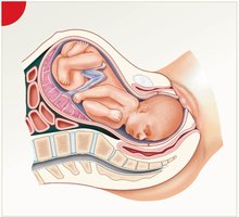 Dilation stage of labor