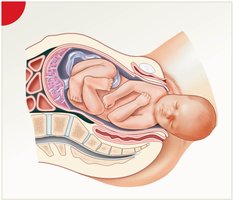 Expulsion stage of labor