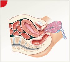 Placental stage of labor