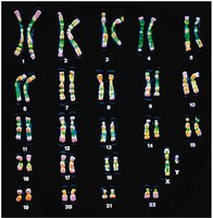 Human male karyotype