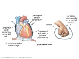 Anatomy of the pericardial cavity and pericardium