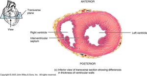 Transverse section showing differences in ventricular wall thickness
