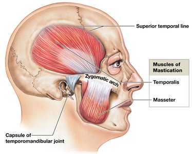 Muscles of mastication, lateral view