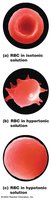 Red blood cells in isotonic, hypertonic, and hypotonic solutions