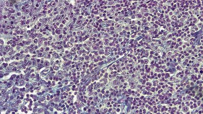 Reticular Connective Tissue microscope slide