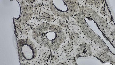 Dense Bone microscope slide