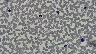 Blood smear microscope slide