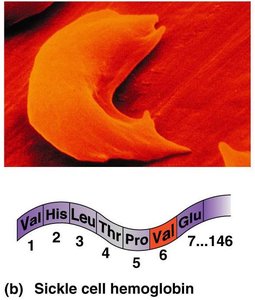 Sickled erythrocyte and hemoglobin sequence