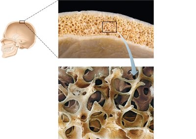 Compact bone and spongy bone (diploë).