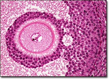 Histological section of antral follicle