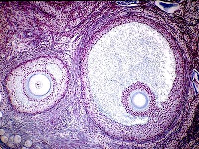 Histological section showing corpus luteum
