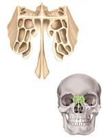 Ethmoid bone with labeled landmarks