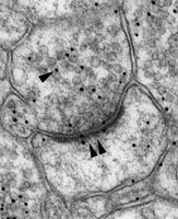Electron micrograph of a synapse