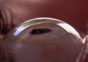 Vascular tunic of the eye