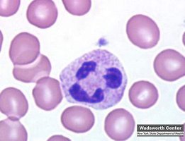 Neutrophil in blood smear