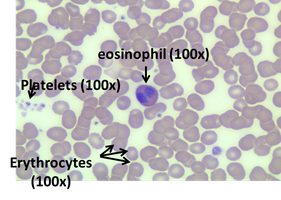 Eosinophil with labeled platelets and erythrocytes