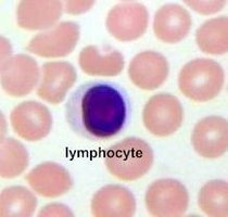 Lymphocyte in blood smear