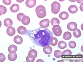 Monocyte in blood smear