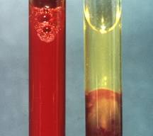 Centrifuged blood sample showing plasma and formed elements