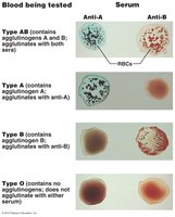 Blood typing agglutination