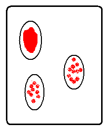Blood typing agglutination results