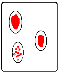 Blood typing agglutination results