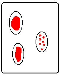 Blood typing agglutination results