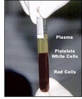 Blood sample showing plasma, platelets, white cells, and red cells