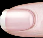 Close-up image of a fingernail showing nail structure