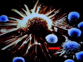T cells attacking a tumor cell