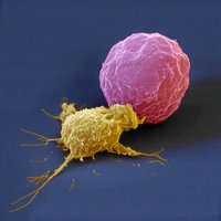 NK cell attacking a cancer cell