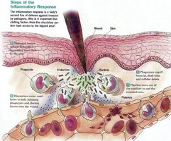 Steps of the inflammatory response