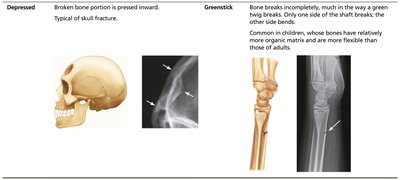 Depressed and greenstick fractures