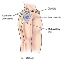 Deltoid IM injection site