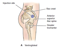 Ventrogluteal IM injection site