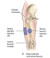 Vastus lateralis IM injection site