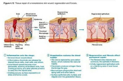 Diagram showing the stages of tissue repair: inflammation, organization, regeneration/fibrosis
