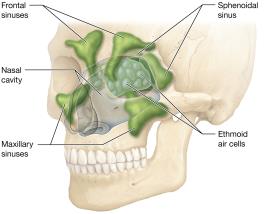Paranasal sinuses, anterolateral view